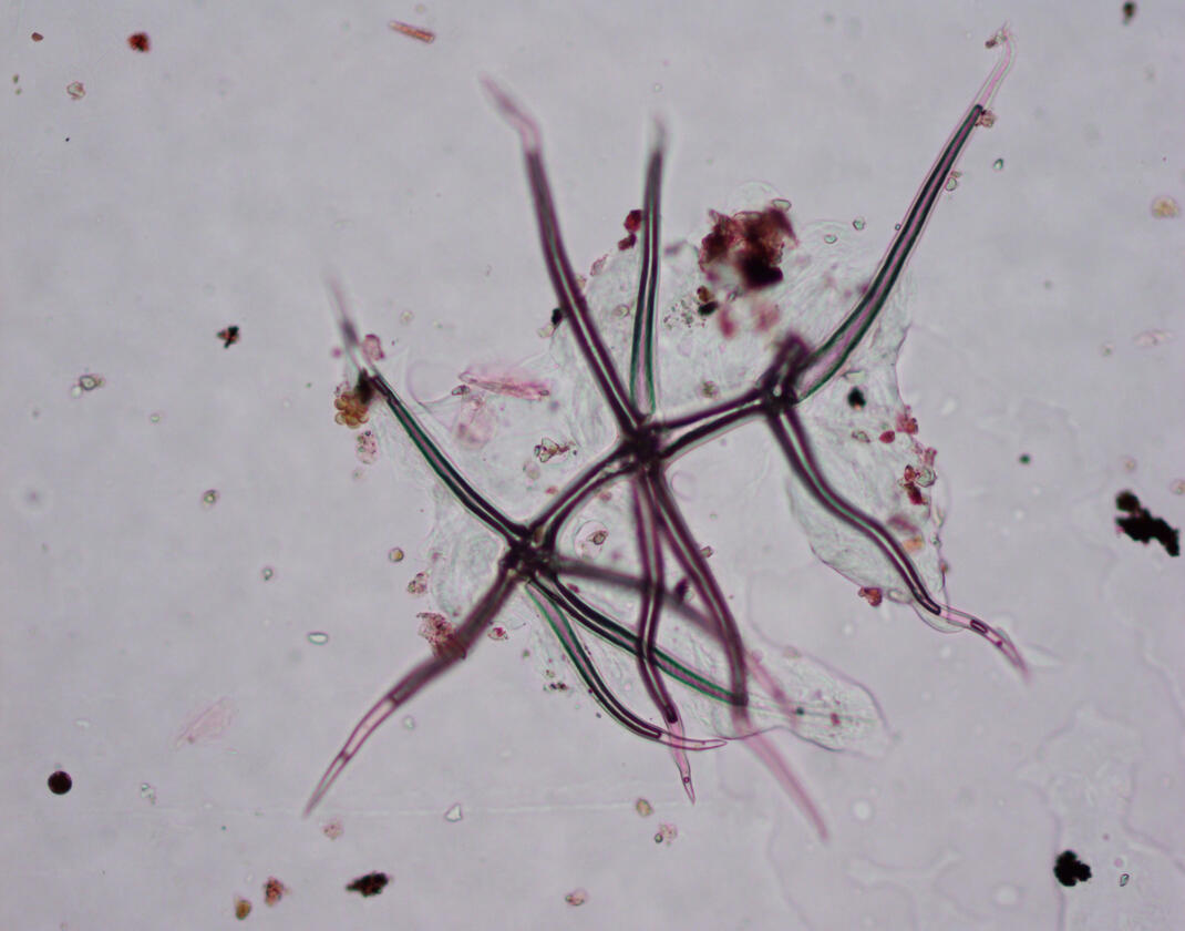 Pollen - photos taken by Dr. Letty Weger