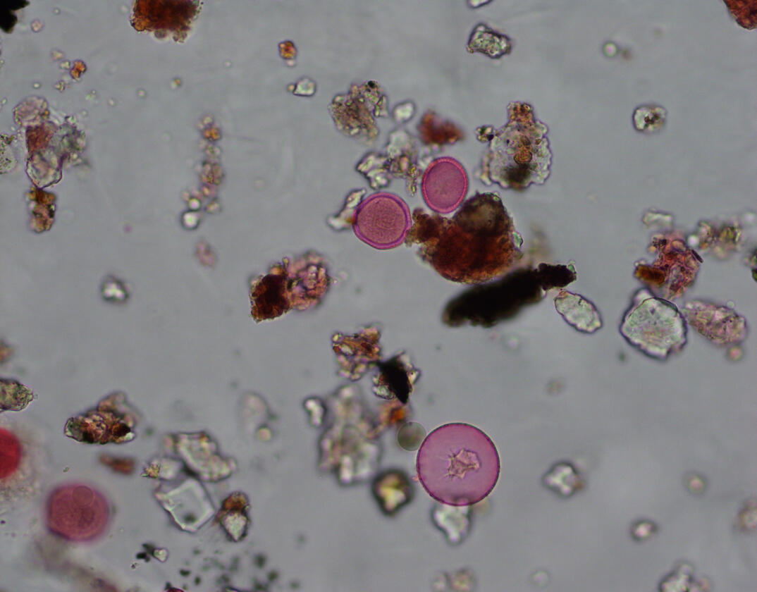 Pollen - photos taken by Dr. Letty Weger