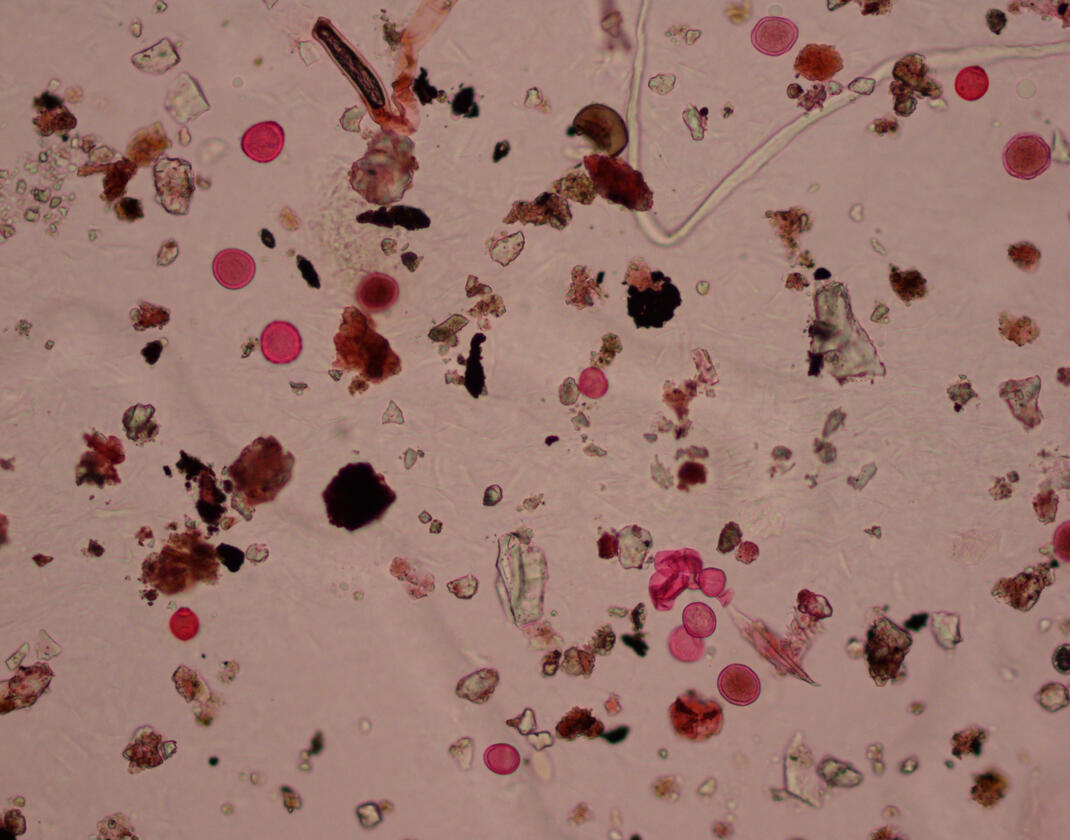 Pollen - photos taken by Dr. Letty Weger